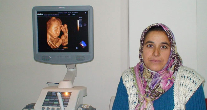 Düşünen bebeğin annesi, havale geçirmesinden korkuyor Konya,ultrason