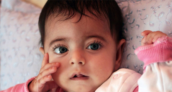 Şifanur bebek nakil için sıra bekliyor adana,mermer kemik hastalığı,osteopetrosis,şifanur bebek