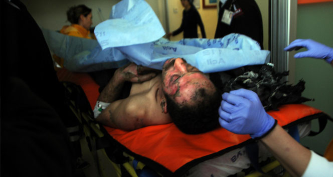 Barışmak isteyen adamı eşi ve çocuğu yaktı&nbsp;aantalya,barışmak isteyen koca