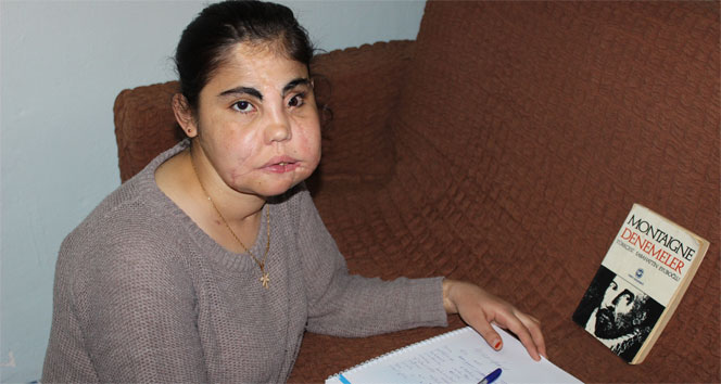 Yeni yüzüne kavuşan Hatice kitap yazdı&nbsp;Hatice,kitap,yüz nakli