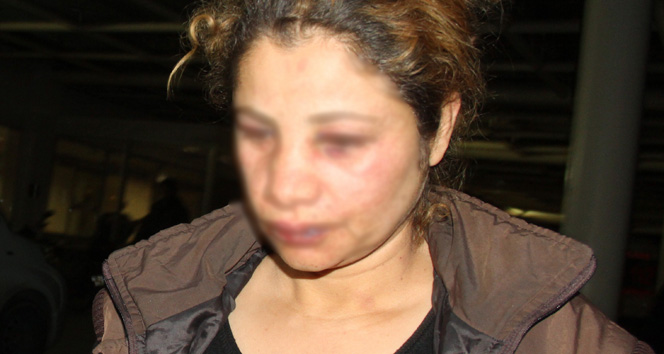 Dayakçı koca: ‘Eşimi ayıltmak için tokatladım’&nbsp;dayakçı koca